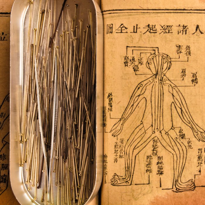 acupuncture book and needles acupuncture book and needles