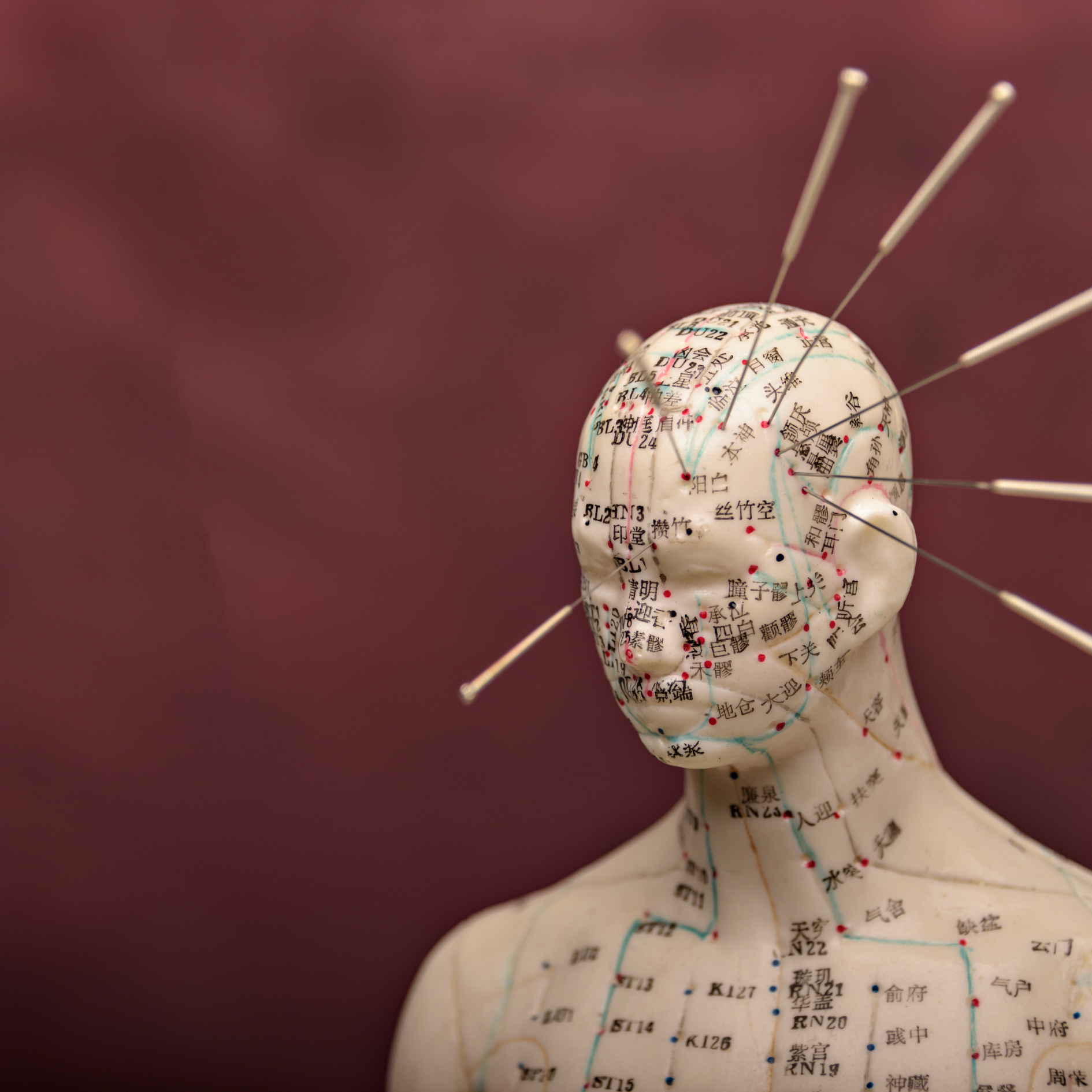 acupuncture meridians