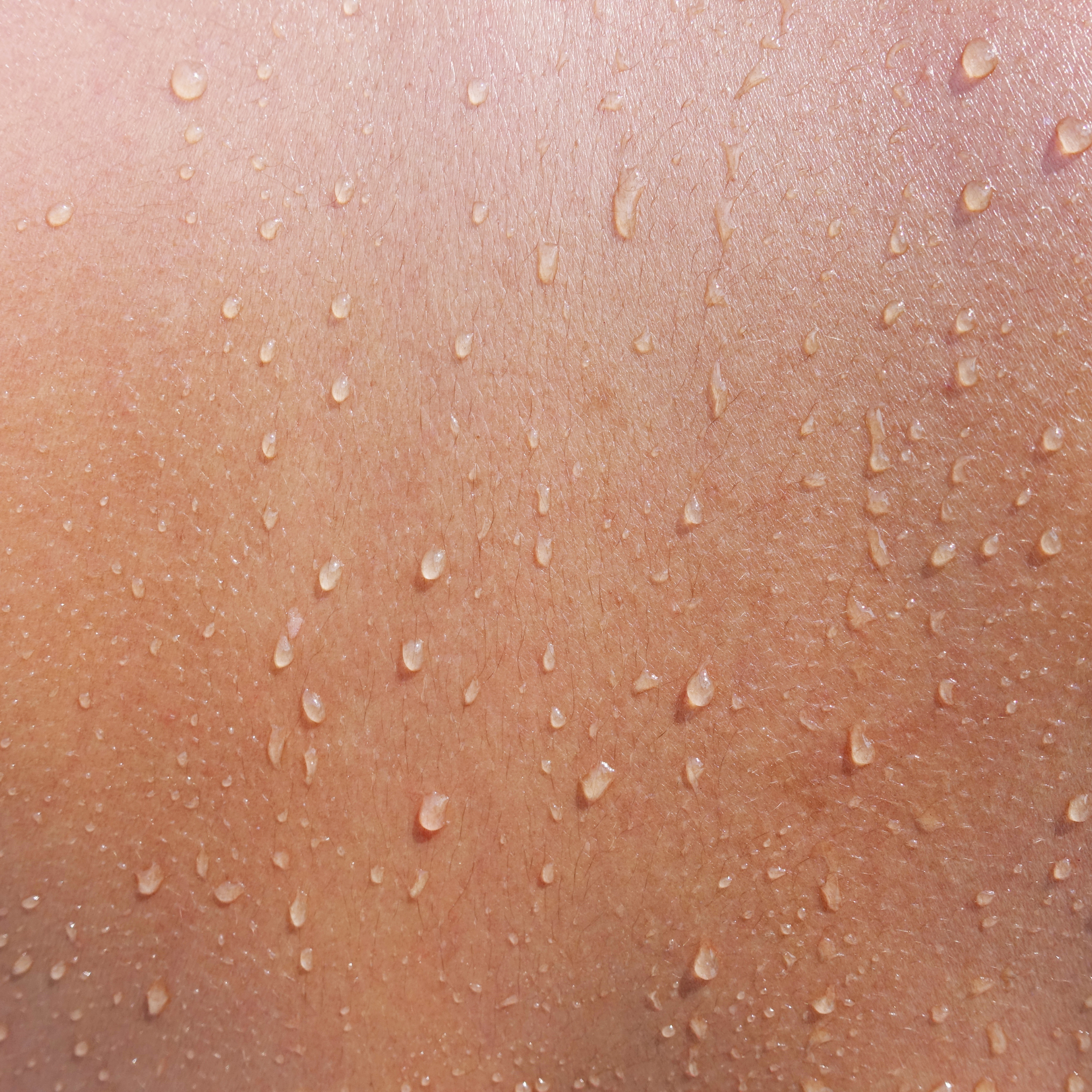 skin