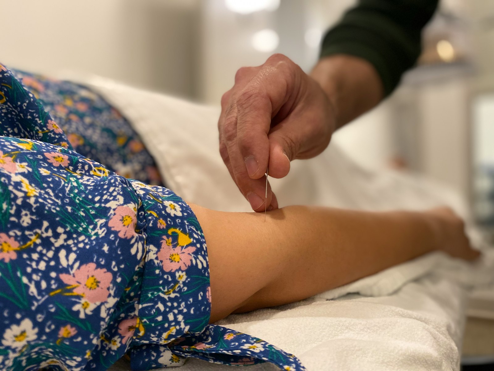 A registered acupuncturist placing sterile needles during a calm treatment session